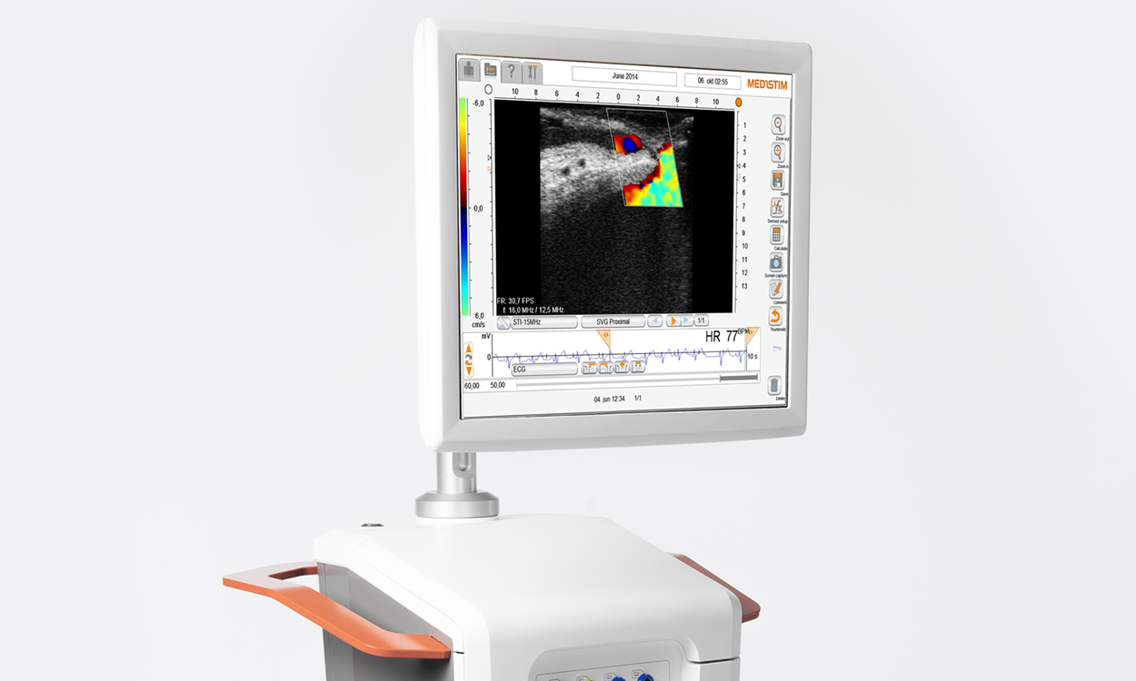bilde av medistim skjerm